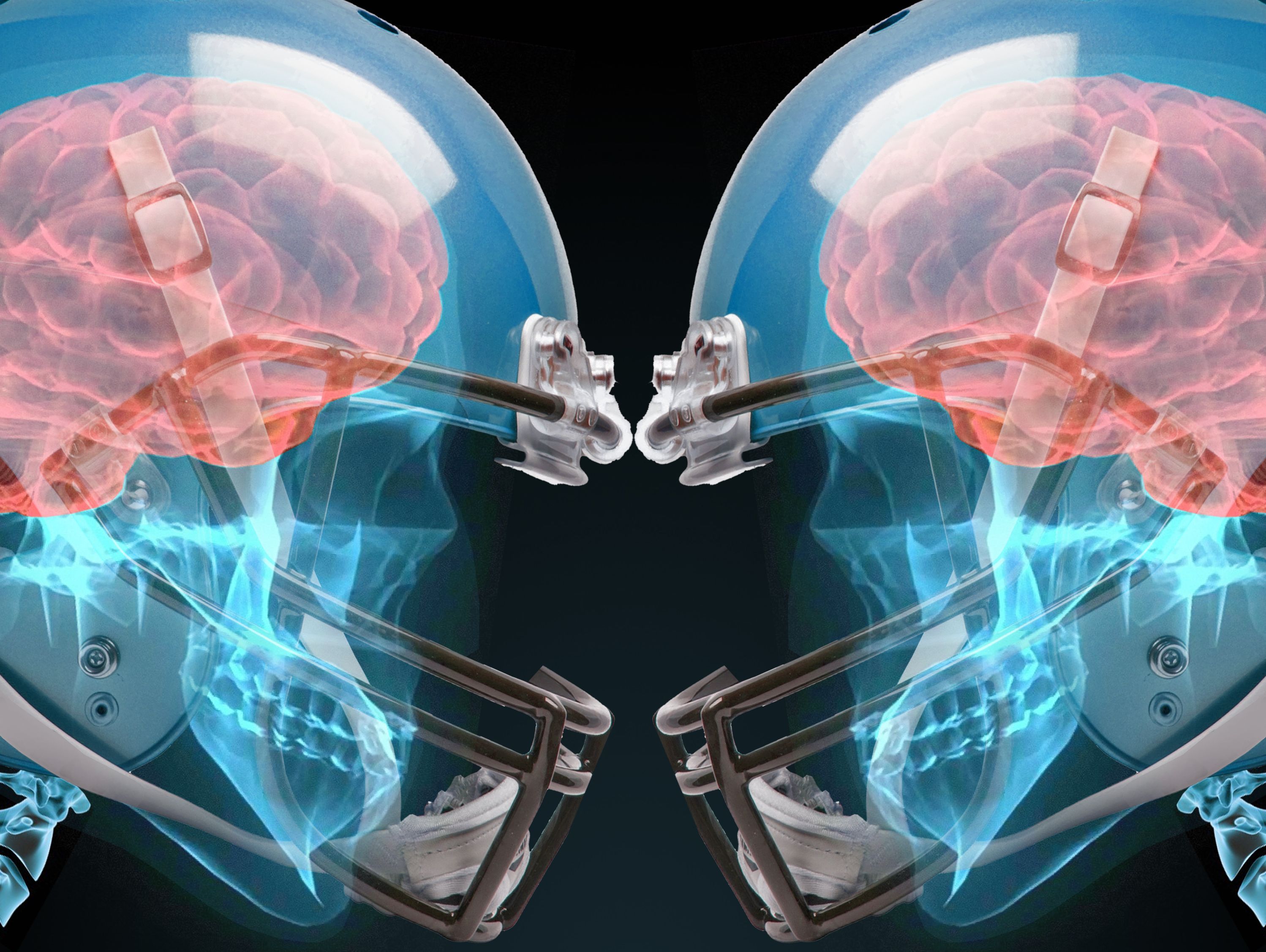 Brain Injuries in Sport The Invisible Killer Sports Law
