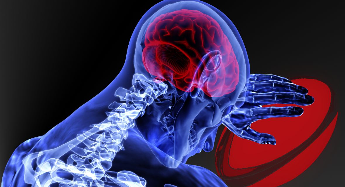 Brain Injuries in Sport: Remedies under English Law