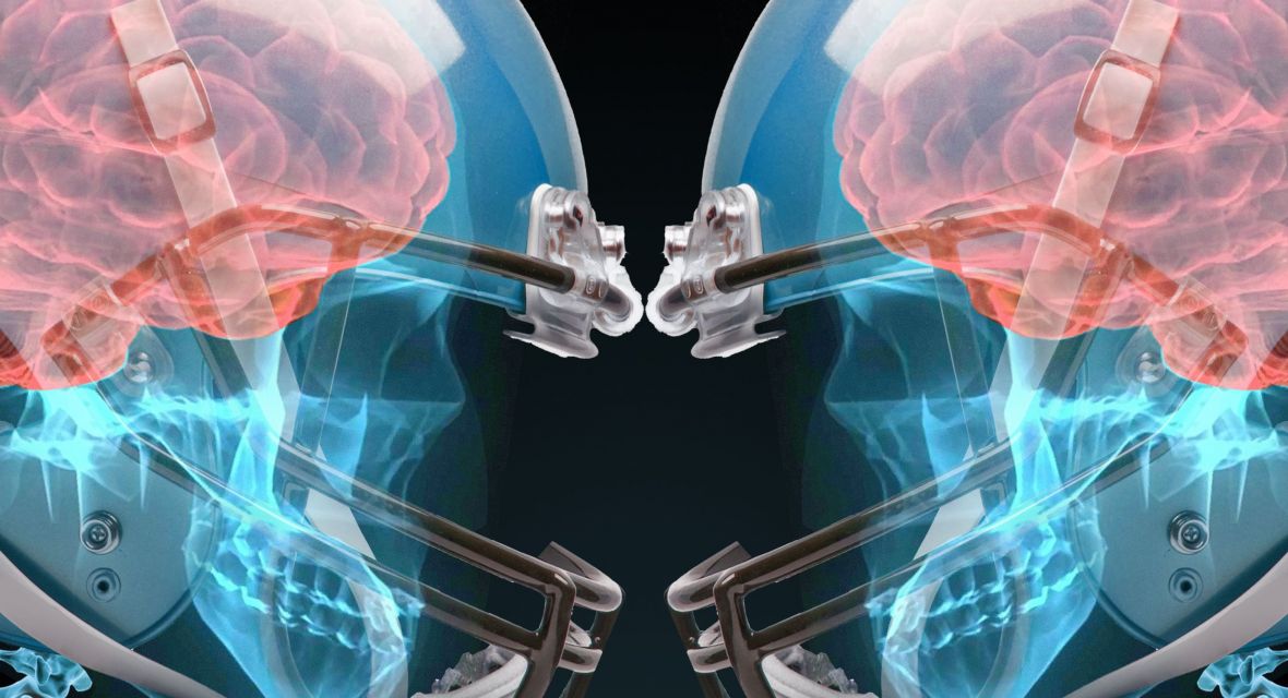 Brain Injuries in Sport: The Invisible Killer